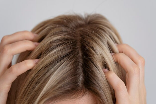 Healthy Scalp, Happy Hair: Hair Oil for Dandruff